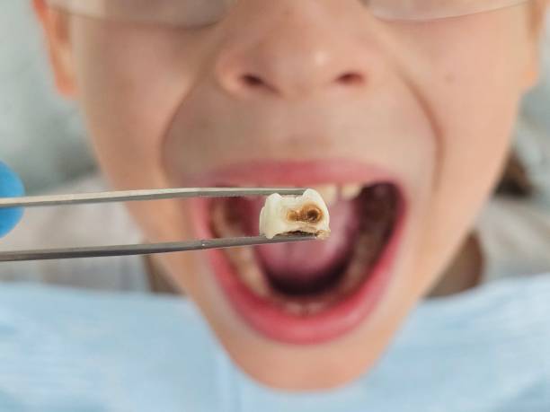 Best Orthodontic Emergency Dentist in Sage, CA