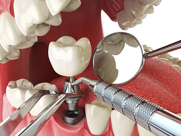 Best Orthodontic Emergency Dentist in Sage, CA